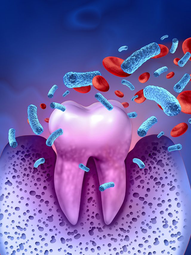 Did you know that gum disease can shorten your life?