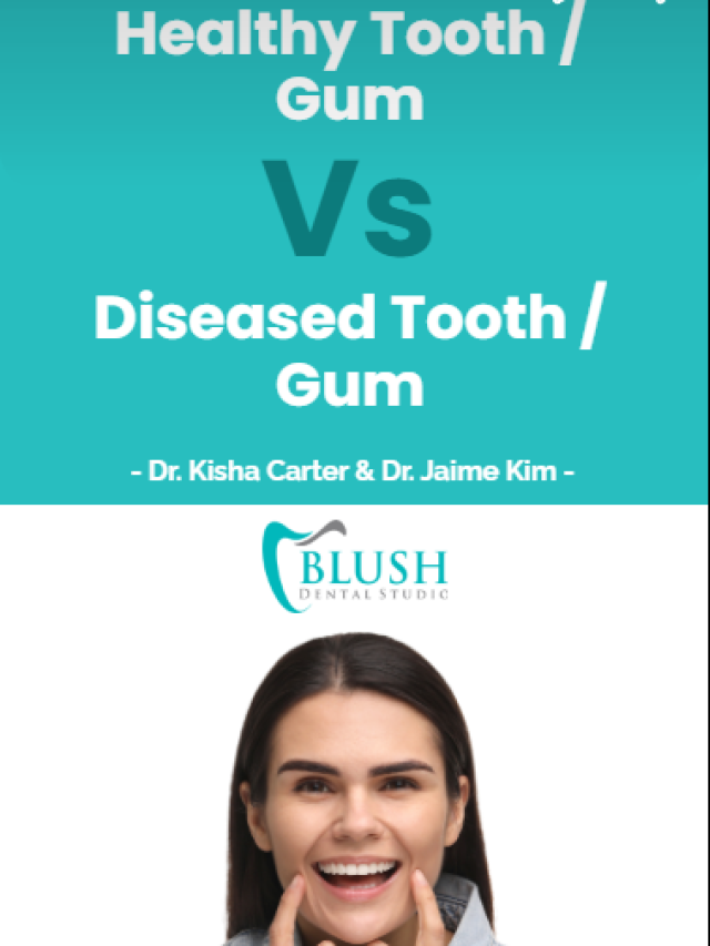 Healthy Tooth / Gum