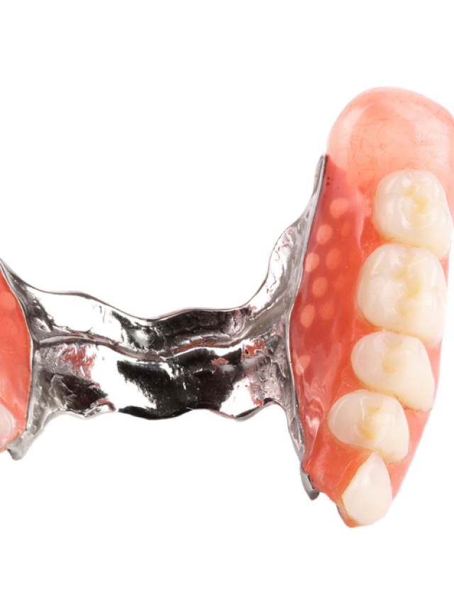 What to consider when choosing Partial Dentures