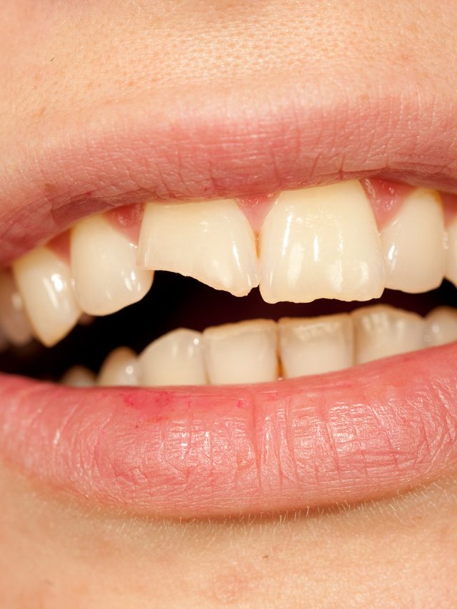 Decayed or damaged teeth?